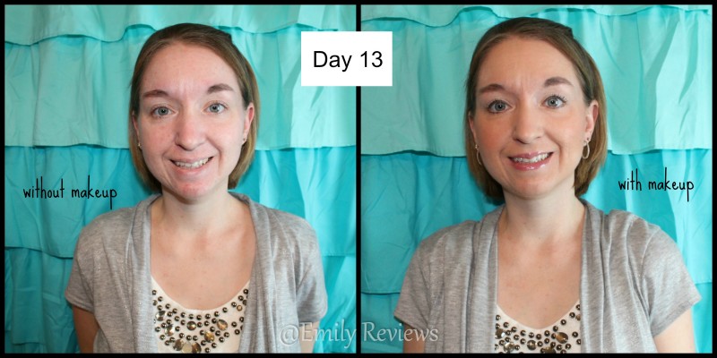 My journey with Unblemish Regimen from Rodan + Fields