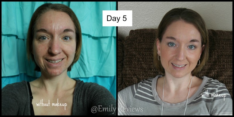 My journey with Unblemish Regimen from Rodan + Fields