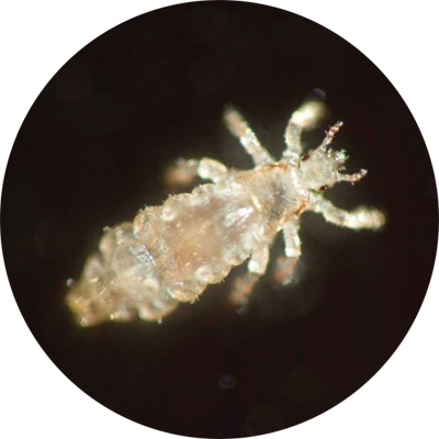 Head Lice