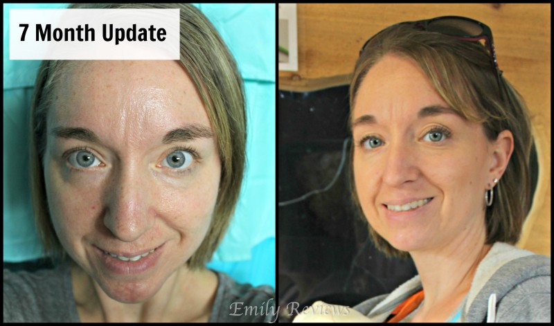 Rodan + Fields {UnBlemish Line} 7 Month Update Post SPOILER: I LOVE R+F!