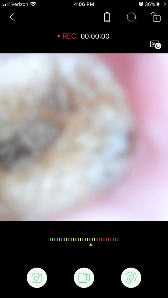 VITCOCO Wireless Otoscope Lets You Look Inside Your Own Ears! {Review