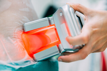 Cryolipolysis, fat freezing treatment for weight loss